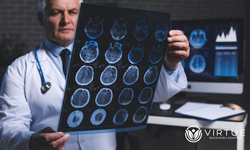 Brain imaging studies